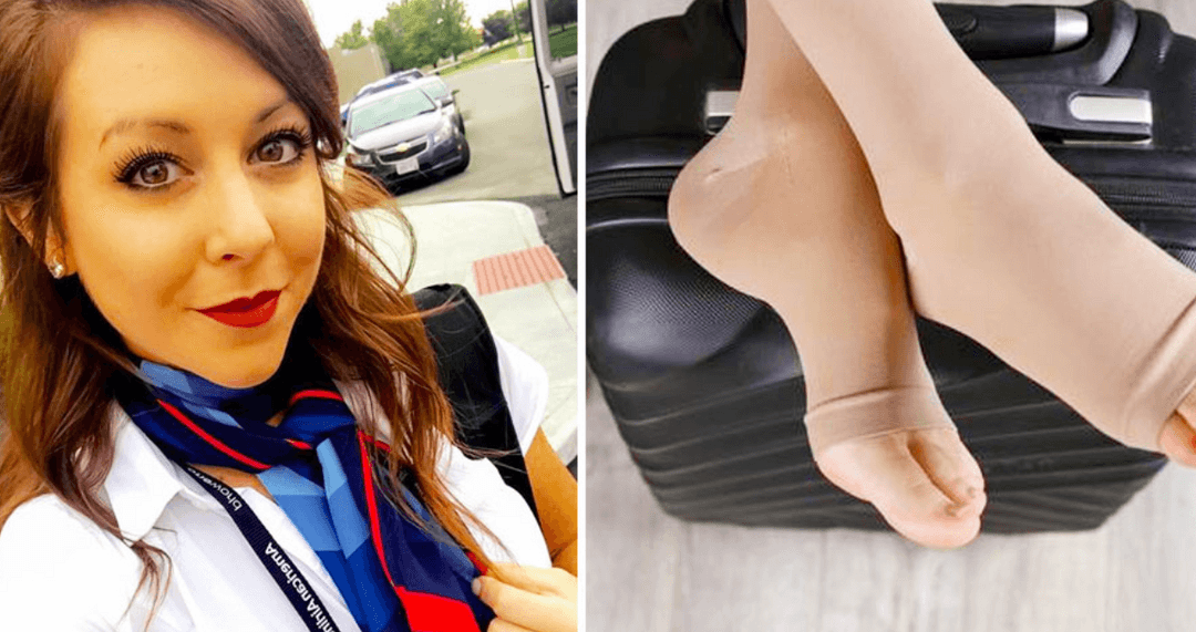 My Compression Sock Journey